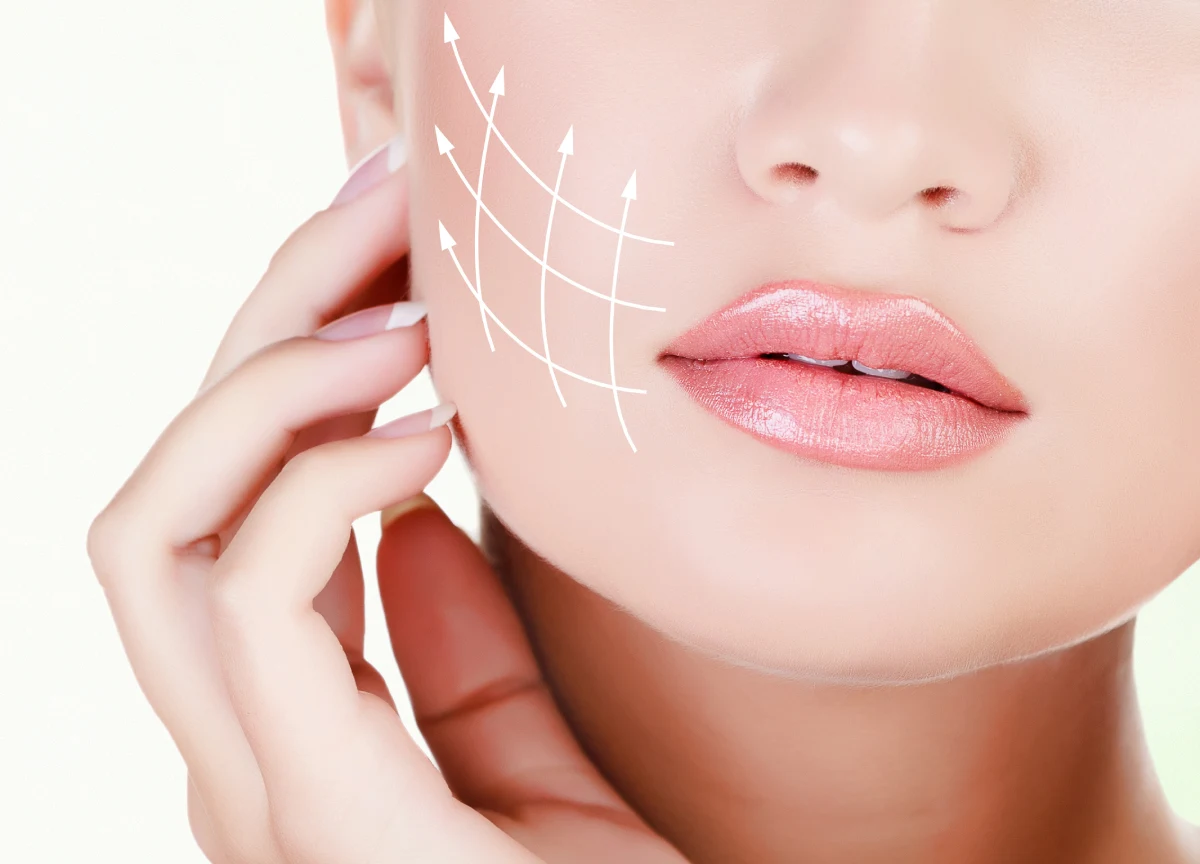 Benefits of PDO Thread Lift